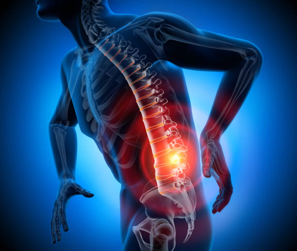 Best Doctor for Slipped Disc Treatment in Badlapur